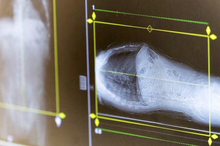 «Онкология в полном объеме» «Онкология в полном объеме»